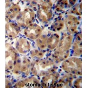 COP9 Signalosome Subunit 2 (COPS2) Antibody