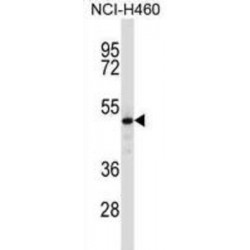 COP9 Signalosome Subunit 2 (COPS2) Antibody