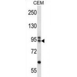 Armadillo Repeat Containing 9 (ARMC9) Antibody