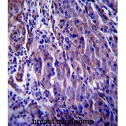 Cyclin Dependent Kinase Inhibitor 1A (CDKN1A) Antibody