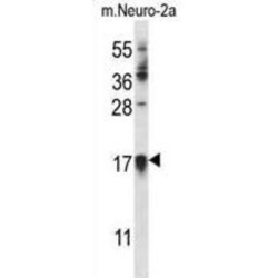 Cyclin Dependent Kinase Inhibitor 1A (CDKN1A) Antibody