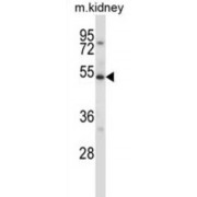 Unc-51 Like Kinase 3 (ULK3) Antibody