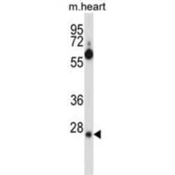 Splicing Factor, Arginine/serine-Rich 2B (SFRS2B) Antibody
