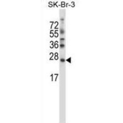 Stromal Cell Derived Factor 2 Like Protein 1 (SDF2L1) Antibody