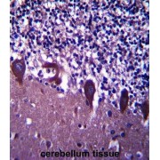 Transducin-Like Enhancer Protein 6 (TLE6) Antibody