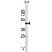 Forkhead Box Protein N4 (FOXN4) Antibody