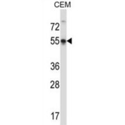 POU Class 3 Homeobox 3 (POU3F3) Antibody