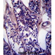 Coiled-Coil Domain-Containing Protein 99 (CCDC99) Antibody
