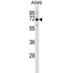 Coiled-Coil Domain-Containing Protein 99 (CCDC99) Antibody