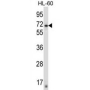 Zinc Finger Protein 415 (ZNF415) Antibody