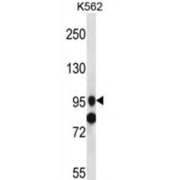 SID1 Transmembrane Family Member 1 (SIDT1) Antibody