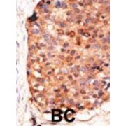 DNA dC->dU-Editing Enzyme APOBEC-3G (APOBEC3G) Antibody