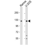 WB analysis of (1) Ramos, and (2) U-2OS whole cell lysates, using UBN2 antibody (1/1000 dilution). Predicted band size: 146 kDa. Blocking/Dilution buffer: 5% NFDM/TBST.