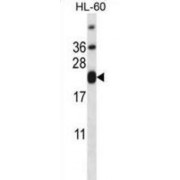 T-Cell Surface Glycoprotein CD3 Epsilon Chain (CD3E) Antibody