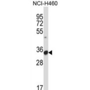 abx027447