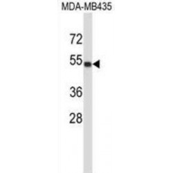 Tubulin Alpha 4A (TUBA4A) Antibody