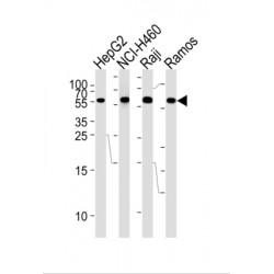 Matrix Metalloproteinase 3 / Stromelysin-1 (MMP3) Antibody