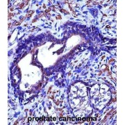 Actin, Gamma 2, Smooth Muscle (ACTG2) Antibody