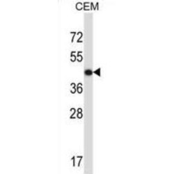 Actin, Gamma 2, Smooth Muscle (ACTG2) Antibody