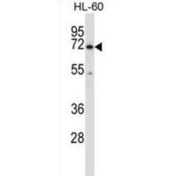 Tyrosine-Protein Kinase BTK (BTK) Antibody