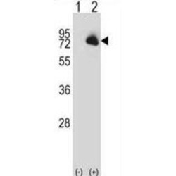 Tyrosine-Protein Kinase BTK (BTK) Antibody