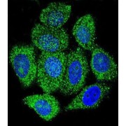 Inosine-5'-Monophosphate Dehydrogenase 1 (IMPDH1) Antibody