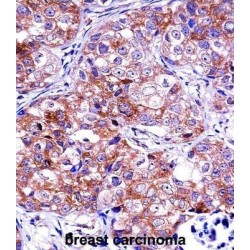 Inosine-5'-Monophosphate Dehydrogenase 1 (IMPDH1) Antibody