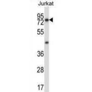 WB analysis of Jurkat cell line lysates.