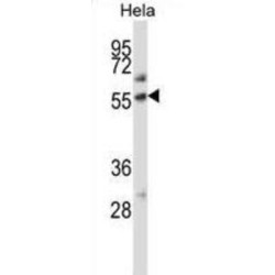 Alkaline Phosphatase, Placental Type (ALPP) Antibody