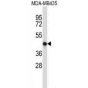 Nuclear Factor, Erythroid 2 (NFE2) Antibody