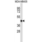 Nuclear Factor, Erythroid 2 (NFE2) Antibody