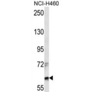 WB analysis of HCI-H460 cell lysates.