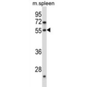Protein Dok-7 (DOK7) Antibody
