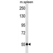 Ubiquitin Specific Peptidase 40 (USP40) Antibody
