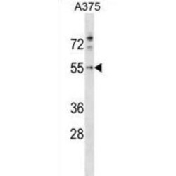 Programmed Cell Death 7 (PDCD7) Antibody