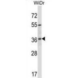 RIB43A Domain With Coiled-Coils 2 (RIBC2) Antibody