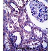 Epithelial Membrane Protein 2 (EMP2) Antibody