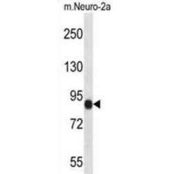 Chondroitin Sulfate Synthase 1 (CHSY1) Antibody