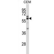 Coronin-2A (CORO2A) Antibody