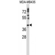 DnaJ Homolog Subfamily C Member 28 (DNAJC28) Antibody