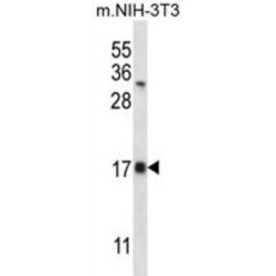 Selenoprotein K (SELK) Antibody