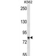 Sterile Alpha Motif Domain Containing 4B (SAMD4B) Antibody