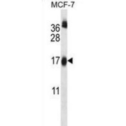 Ubiquitin-Conjugating Enzyme E2 W (UBE2W) Antibody