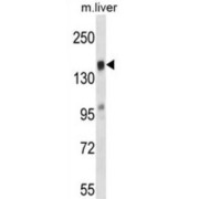T-Lymphoma Invasion And Metastasis-Inducing Protein 2 (TIAM2) Antibody