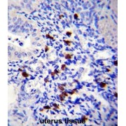 Tenascin-N (TNN) Antibody
