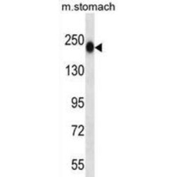 Tenascin-N (TNN) Antibody