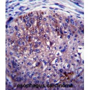 abx027505