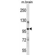 Itchy E3 Ubiquitin Protein Ligase (ITCH) Antibody