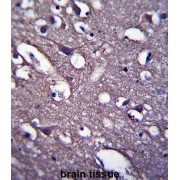Proline-Rich Protein 18 (PRR18) Antibody