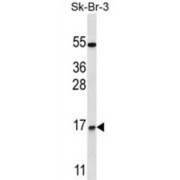 NOTCH Regulated Ankyrin Repeat Protein (NRARP) Antibody